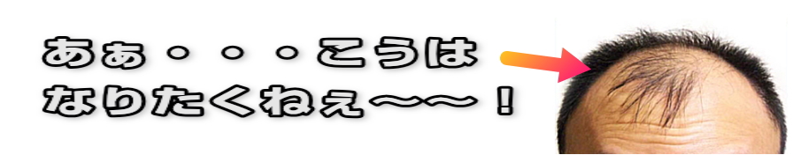 ブブカ 育毛剤 効果なし 失敗しようがない選び方とは